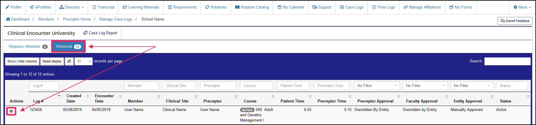 Case log table highlighting the eye icon under the Actions column historic view.